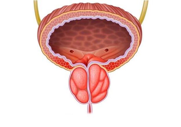 Behandlung vu Prostatitis bei Männer